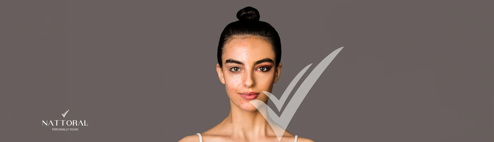 Is It Safe To Wear Makeup Over Acne? A Complete Guide